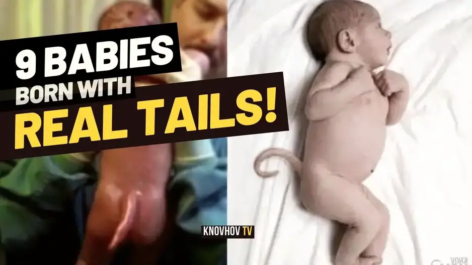 Knovhov TV on X: Abby and Brittany Hensel: Conjoined twins are very rare  in the world. Since they have two brains, they should be regarded as two  separate participants in examinations and